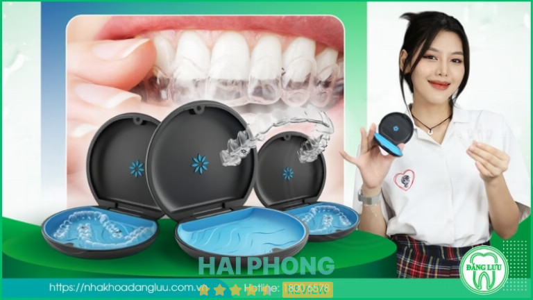 Dịch vụ niềng răng tại Nha Khoa Đăng Lưu